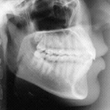 Radiologia Odontológica em Anápolis